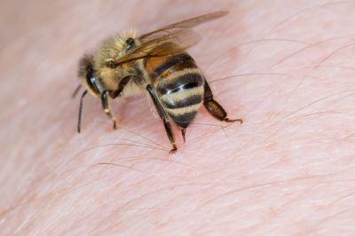 Prevention of Stings